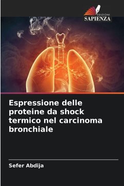 Cover Espressione delle proteine da shock termico nel carcinoma bronchiale