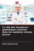 Le rôle des marqueurs peptidiques urinaires dans les maladies rénales graves Le rôle des marqueurs peptidiques urinaires dans les maladies rénales graves