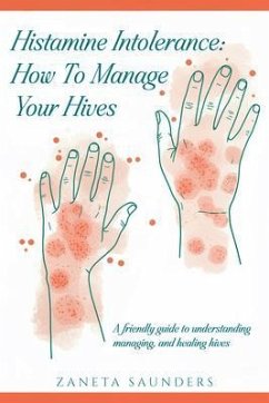 Cover Histamine Intolerance: How To Manage Your Hives: A friendly guide to understanding, managing, and healing hives: How To Manage Your Hives: (eBook, ePUB)