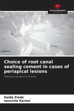 Cover Choice of root canal sealing cement in cases of periapical lesions