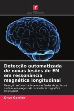 Cover Detecção automatizada de novas lesões de EM em ressonância magnética longitudinal