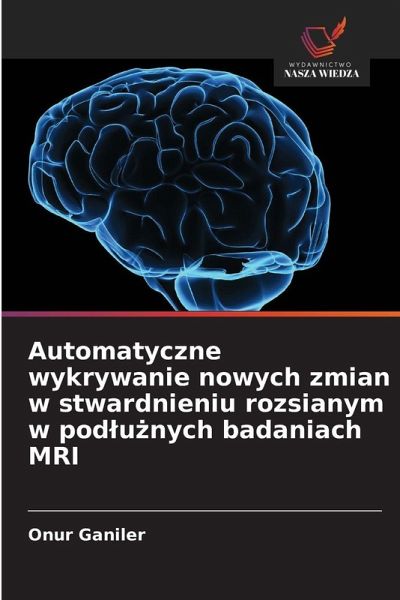 Automatyczne wykrywanie nowych zmian w stwardnieniu rozsianym w pod¿u¿nych badaniach MRI Automatyczne wykrywanie nowych zmian w stwardnieniu rozsianym w pod¿u¿nych badaniach MRI