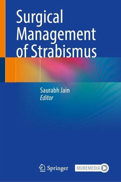 Cover Surgical Management of Strabismus (eBook, PDF)