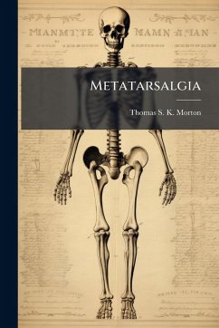 Cover Metatarsalgia
