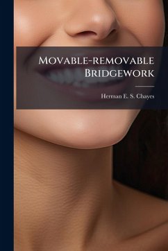 Cover Movable-removable Bridgework