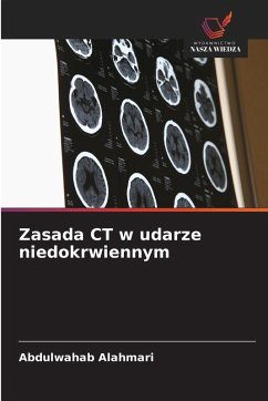 Cover Zasada CT w udarze niedokrwiennym