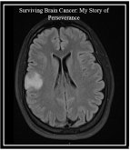 Surviving Brain Cancer: My Story of Perseverance (eBook, ePUB)