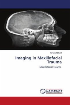 Cover Imaging in Maxillofacial Trauma