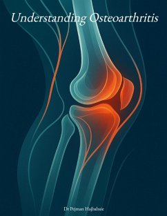 Cover Understanding Osteoarthritis (2nd Edition) (eBook, ePUB)