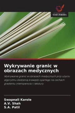 Cover Wykrywanie granic w obrazach medycznych