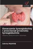 Oznaczanie tyreoglobuliny i przeciwcial przeciwko tyreoglobulinie Oznaczanie tyreoglobuliny i przeciwcial przeciwko tyreoglobulinie