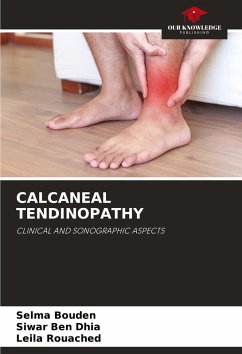 CALCANEAL TENDINOPATHY - Bouden, Selma;Ben Dhia, Siwar;Rouached, Leila
