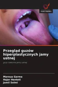 Cover Przeglad guzów hiperplastycznych jamy ustnej