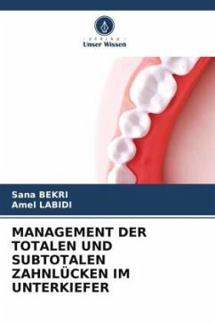 Cover MANAGEMENT DER TOTALEN UND SUBTOTALEN ZAHNLÜCKEN IM UNTERKIEFER