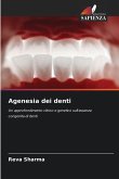 Agenesia dei denti