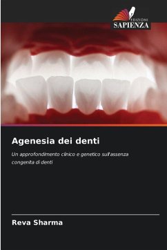 Cover Agenesia dei denti