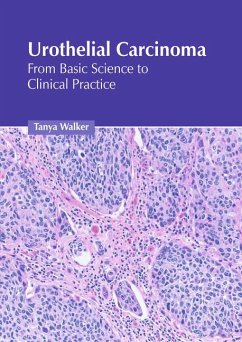 Urothelial Carcinoma: From Basic Science to Clinical Practice