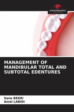 MANAGEMENT OF MANDIBULAR TOTAL AND SUBTOTAL EDENTURES - Bekri, Sana;Labidi, Amel