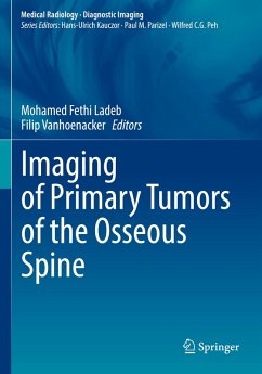 Cover Imaging of Primary Tumors of the Osseous Spine