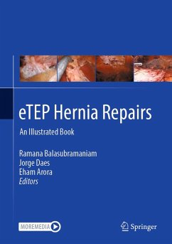 Cover eTEP Hernia Repairs (eBook, PDF)