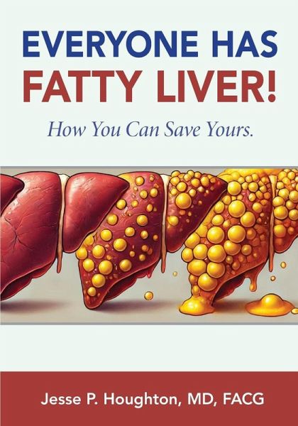 EVERYONE HAS FATTY LIVER!