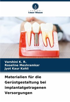 Cover Materialien für die Gerüstgestaltung bei implantatgetragenen Versorgungen