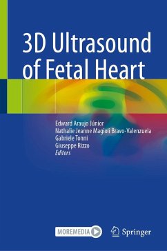 Cover 3D Ultrasound of Fetal Heart (eBook, PDF)