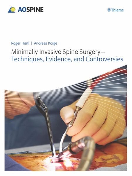 Minimally Invasive Spine Surgery - Techniques, Evidence, and Controversies (eBook, ePUB)