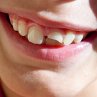 Smiling Through The Pain - Bild 1