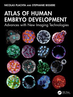 Cover Atlas of Human Embryo Development (eBook, PDF)