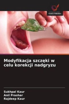 Cover Modyfikacja szcz¿ki w celu korekcji nadgryzu