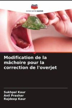 Cover Modification de la mâchoire pour la correction de l'overjet