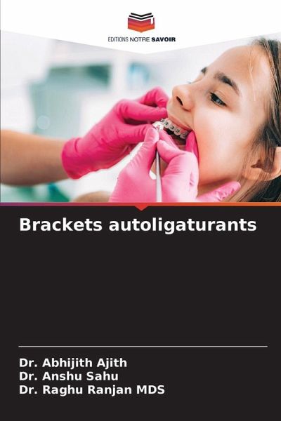 Brackets autoligaturants Brackets autoligaturants