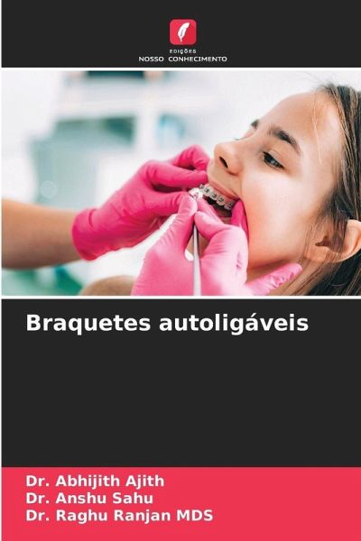 Braquetes autoligáveis