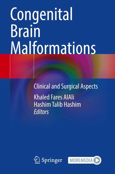 Congenital Brain Malformations Congenital Brain Malformations