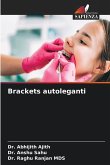 Brackets autoleganti Brackets autoleganti