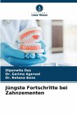 Jüngste Fortschritte bei Zahnzementen Jüngste Fortschritte bei Zahnzementen