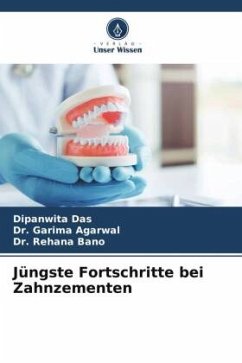 Cover Jüngste Fortschritte bei Zahnzementen