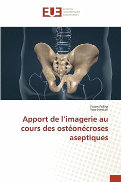 Cover Apport de l'imagerie au cours des ostéonécroses aseptiques