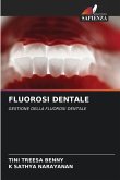FLUOROSI DENTALE