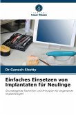 Einfaches Einsetzen von Implantaten für Neulinge Einfaches Einsetzen von Implantaten für Neulinge