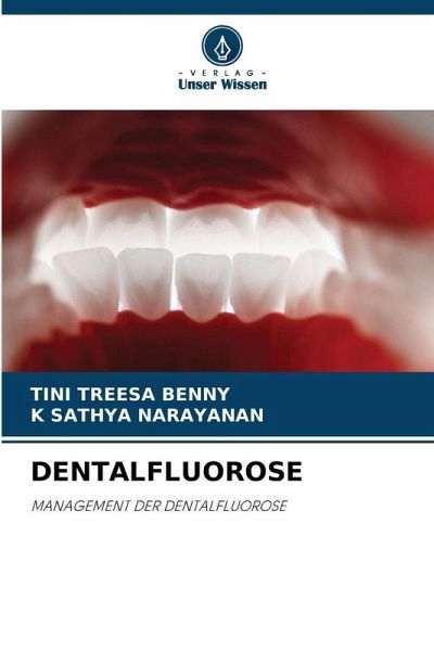 DENTALFLUOROSE DENTALFLUOROSE