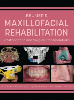 Cover Beumer's Maxillofacial Rehabilitation