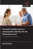 Leczenie zawa¿u serca z uniesieniem odcinka ST od fibrynolizy do P Leczenie zawa¿u serca z uniesieniem odcinka ST od fibrynolizy do P
