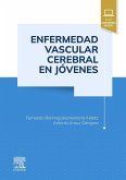 Enfermedad vascular cerebral en jovenes Enfermedad vascular cerebral en jovenes