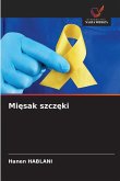 Mi¿sak szcz¿ki Mi¿sak szcz¿ki