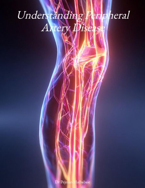 Understanding Peripheral Artery Disease (Understanding Medicine) (eBook, ePUB) Understanding Peripheral Artery Disease (Understanding Medicine) (eBook, ePUB)