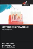 OSTEODENSIFICAZIONE