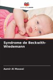 Syndrome de Beckwith-Wiedemann