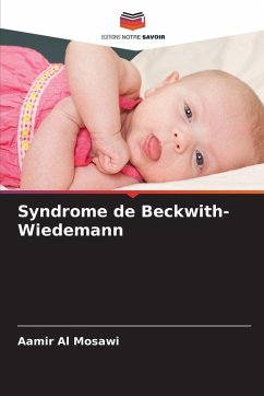 Cover Syndrome de Beckwith-Wiedemann